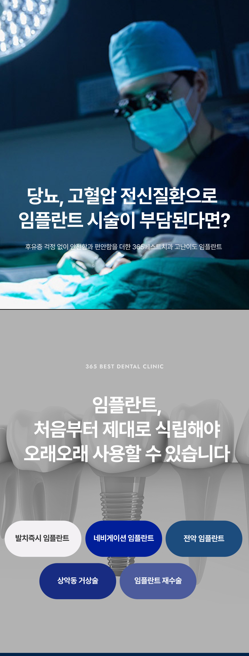 고난이도 임플란트