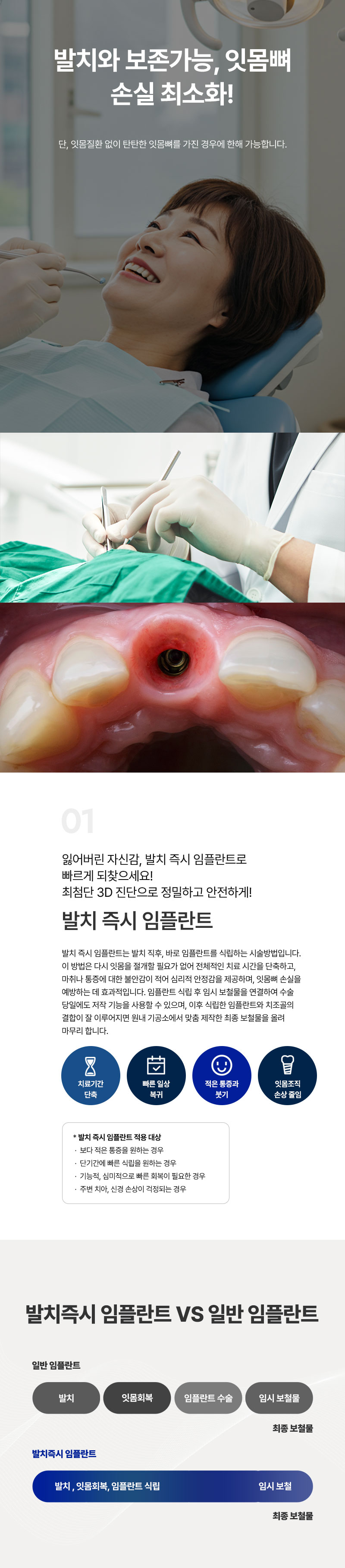 발치즉시 임플란트