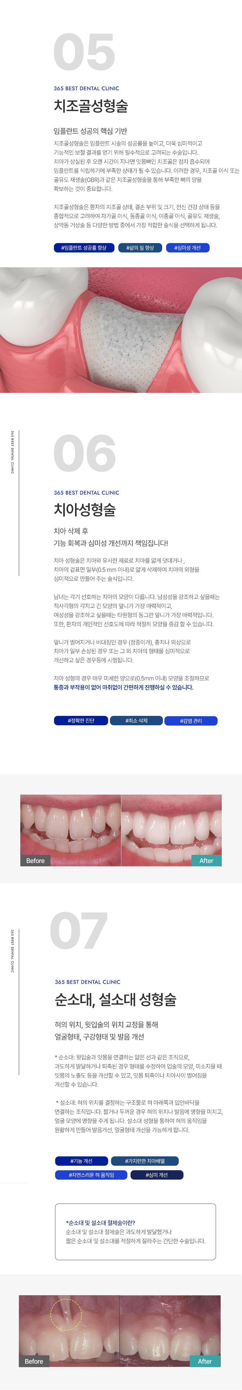 통증완화시스템