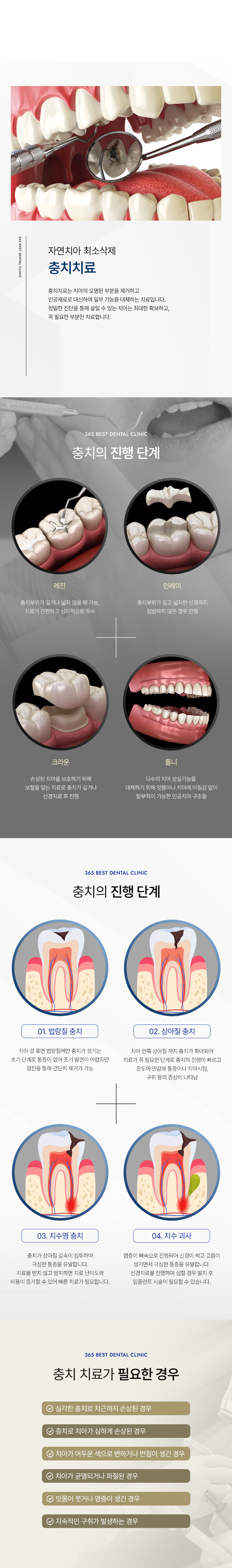 통증완화시스템