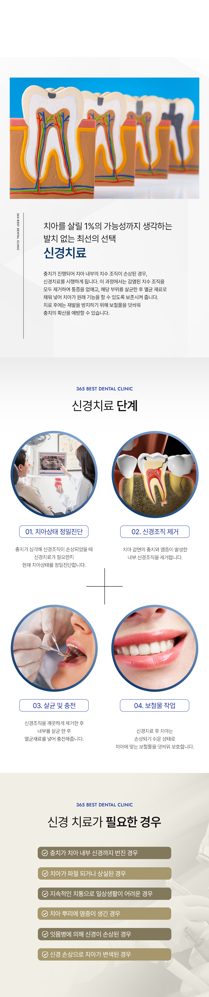 통증완화시스템