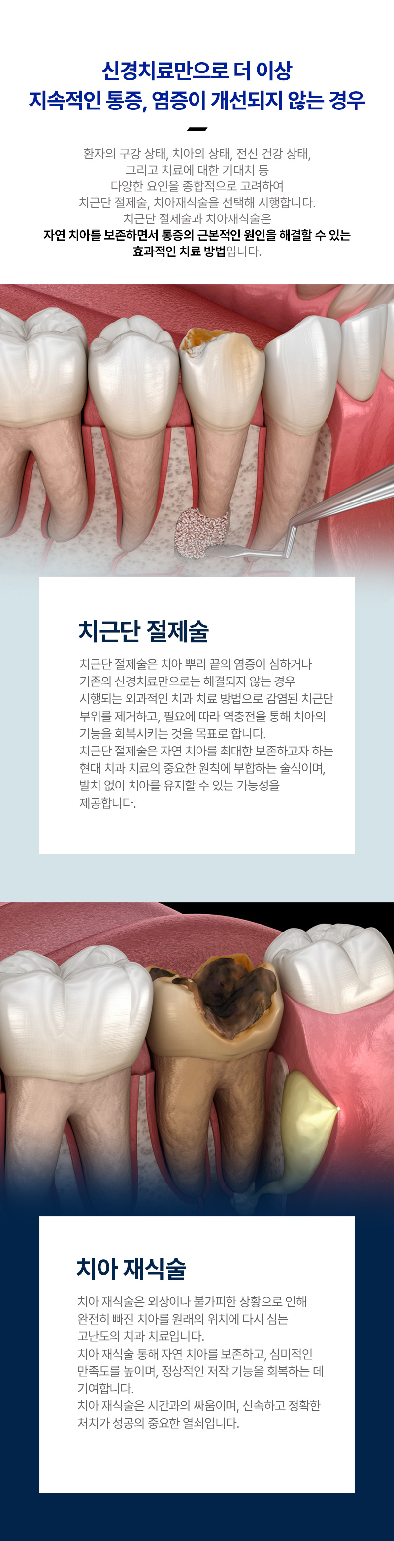 통증완화시스템