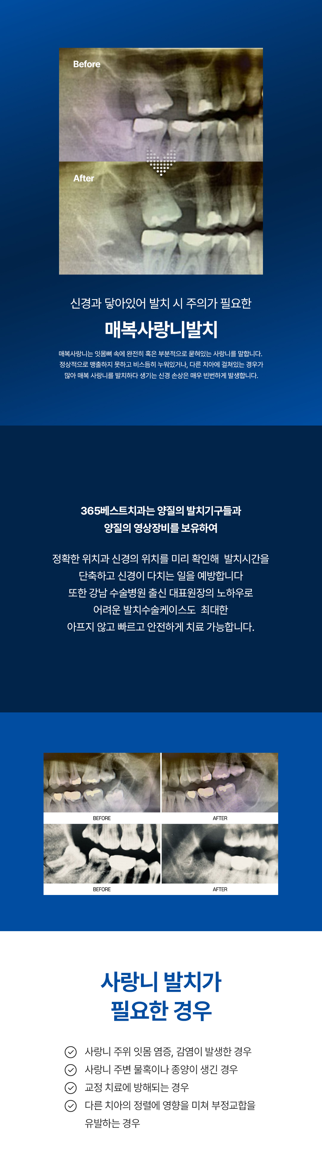 통증완화시스템